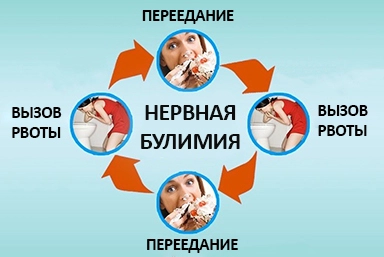 Лечение булимии в Ардоне